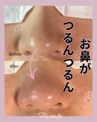 毛穴専門サロン Hanabiのエステ・リラクイメージ