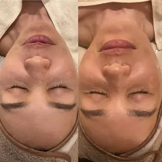 プライベートサロン 座間市/LOKAHIのエステ・リラクイメージ