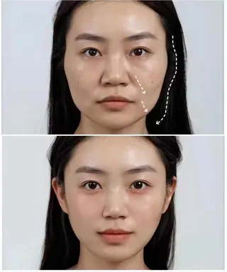 ネイル aliaハーブ水光店 エステティシャン募集のエステ・リラクイメージ