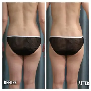 Beauty Salon AQUAのエステ・リラクイメージ