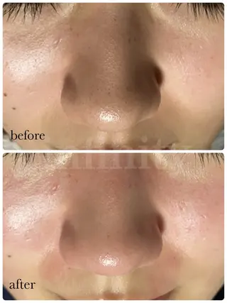 infinity所属・Infinity KAYOのその他イメージ