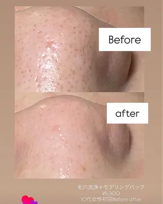 【肌質改善・腸揉み】 Nico laughのエステ・リラクイメージ