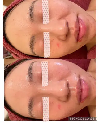 y.laBelle 艶肌・小顔・肌質改善のエステ・リラクイメージ