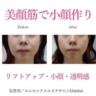 佐賀 痩身・美肌 @uni.clearのエステ・リラクイメージ