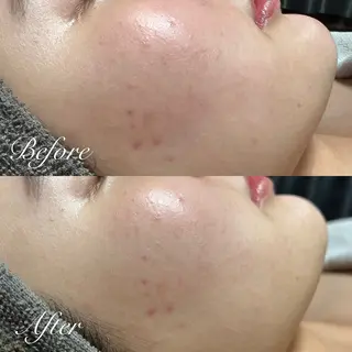 シミ🩷ニキビ専門店 Matteo🎀✨のエステ・リラクイメージ