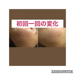 セミロング アニメ,Vオタク× 即効痩せエステサロンのエステ・リラクイメージ