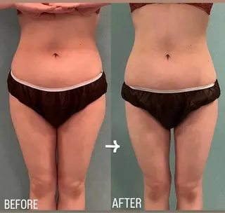 bell zellbeautyのマツエク・マツパデザイン