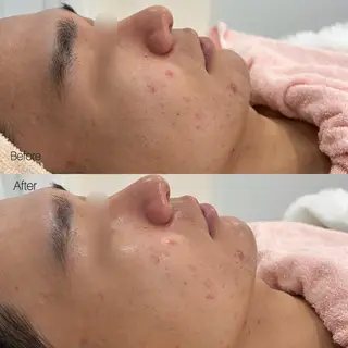 メンズ etre - 韓国肌管理 -のエステ・リラクイメージ