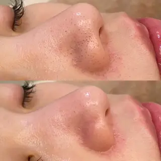 海瀬 浩代のエステ・リラクイメージ