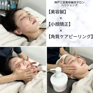 美容鍼・小顔矯正 ハリシェンドのエステ・リラクイメージ