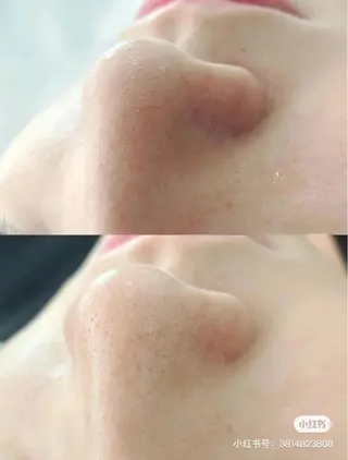 ネイル aliaハーブ水光店 エステティシャン募集のエステ・リラクイメージ