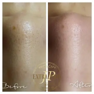 エステサロン Lazulisea所属・川口 春奈のエステ・リラクイメージ