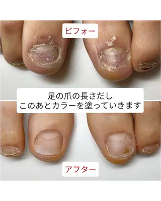 ネイル ネイルサロン アリュームのネイルデザイン