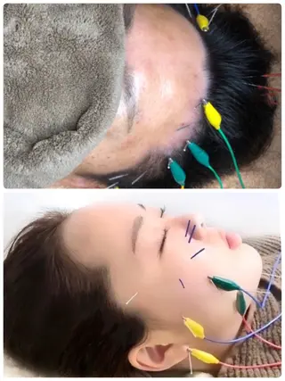 かすがい鍼灸院 Re.heartのエステ・リラクイメージ