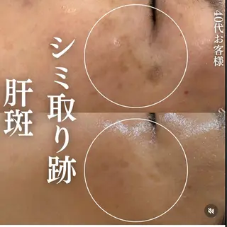 【福岡市西区 エステ】 GRANVIR(グランヴィール)所属・GRANVIR グランヴィールのエステ・リラクイメージ