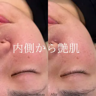 etre - 韓国肌管理 -のエステ・リラクイメージ