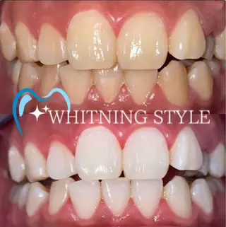 カラー プラチナムビューティー柏所属・【歯科提携】柏ホワイ トニングスタイルのその他イメージ