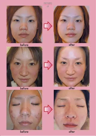 鈴木 琴美のエステ・リラクイメージ