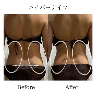 LiLL 熊本のエステ・リラクイメージ