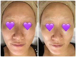 COCO beautyサロンのエステ・リラクイメージ