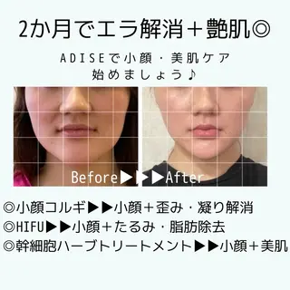 第一印象専門サロン ADISEのエステ・リラクイメージ