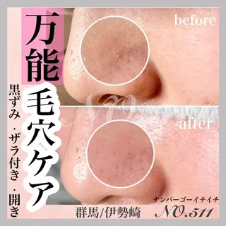 メンズ 脱毛&フェイシャル NO.511のエステ・リラクイメージ