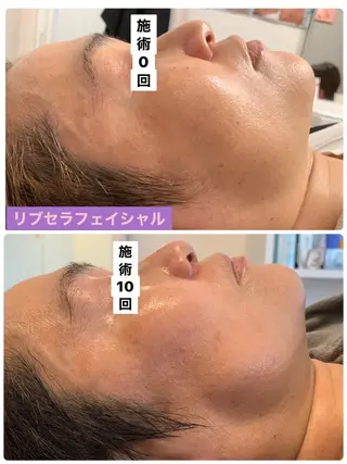 プライベートサロン プリュネルのエステ・リラクイメージ