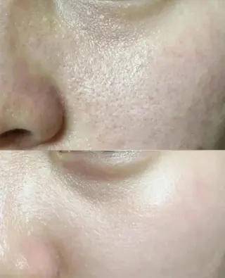 ネイル aliaハーブ水光店 エステティシャン募集のエステ・リラクイメージ