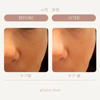 バリ式アロマ＆フェイ シャル_chiakiのエステ・リラクイメージ