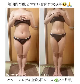 《本気痩せ×疲労改善 》  BILOOPのエステ・リラクイメージ