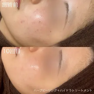 lulularico Yuのエステ・リラクイメージ