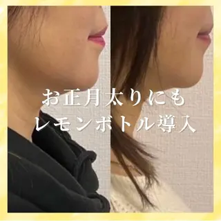 看護師が施術する小顔 サロン/KIKIのエステ・リラクイメージ