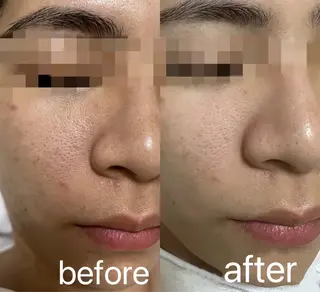 エステサロン lindyのエステ・リラクイメージ