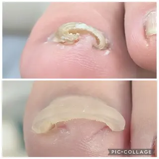 ネイル 爪の病院屋さん所属・安野 真理愛のネイルデザイン