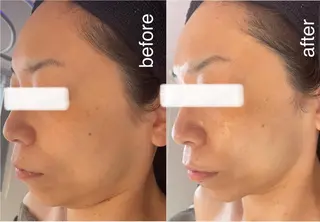 Lavi&所属・肌質改善サロン Ｌａｖｉ＆のその他イメージ