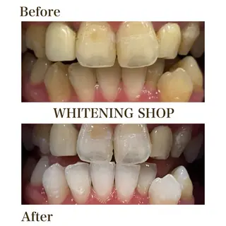 ホワイトニング ショップ葵区静岡駅店のその他イメージ