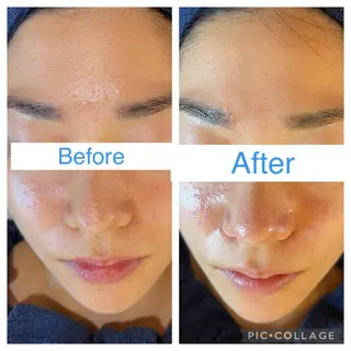 o3remedy所属・宇野澤 彩加のエステ・リラクイメージ