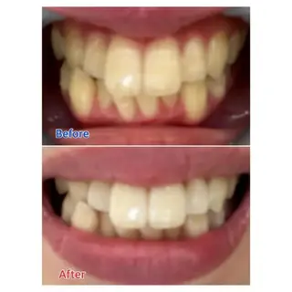 M渋谷 ホワイトニングのエステ・リラクイメージ