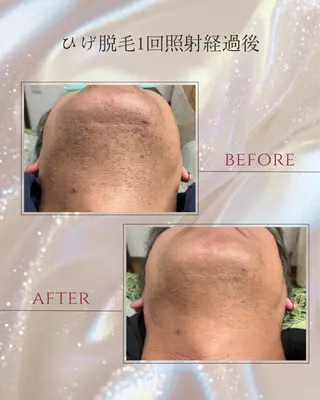 DISINI  SPA所属・DISINISPA 脱毛/フェイシャルのエステ・リラクイメージ