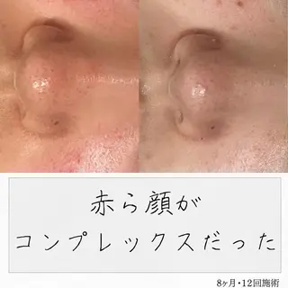 ニキビ経験者が施術 する専門サロン🌻のエステ・リラクイメージ