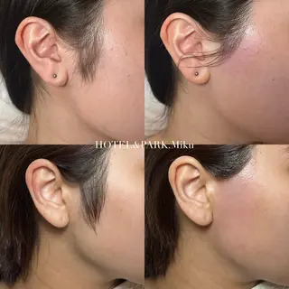 HOTEL&PARK Mikuワックス脱毛のエステ・リラクイメージ