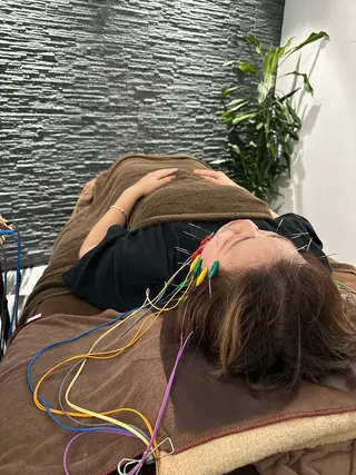 小顔矯/美容鍼/鍼灸 BeauJuのその他イメージ