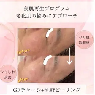 beauty SalonRcoinのマツエク・マツパデザイン