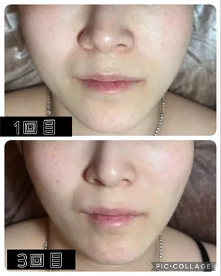 ネイル Feel ‪‪☺︎‬Yuriaのネイルデザイン
