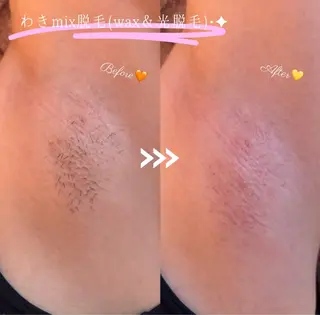 脱毛サロン COCOKANA所属・脱毛サロン COCOKANAの眉毛・アイブロウイメージ