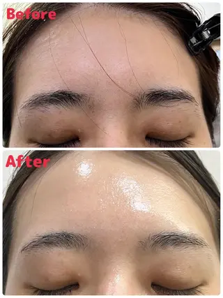 肌の質を変えるエステ 🤍🫧Nanaのエステ・リラクイメージ