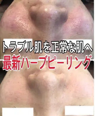 LILIANA ☆YURIのエステ・リラクイメージ