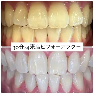 ホワイトニングルーム 横浜店のその他イメージ