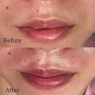 Pinklagoon横浜店所属・Ririko🌼 Pinklagoonのマツエク・マツパデザイン