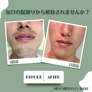 メンズ men's脱毛サロン BASEのエステ・リラクイメージ